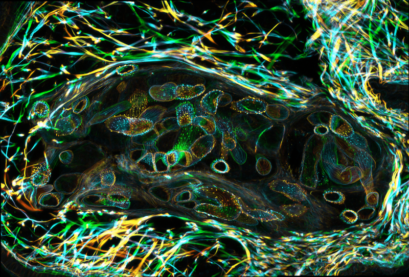 Illustration for article titled The Astounding And Horrific World As Seen Under A Microscope